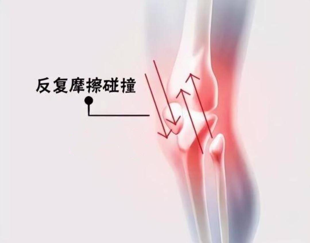包含儿童运动损伤报告：过度训练问题突出的词条
